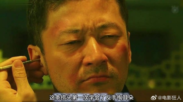 男人第一次反手掏耳朵,意外将20公分耳勺卡在里面 (1)