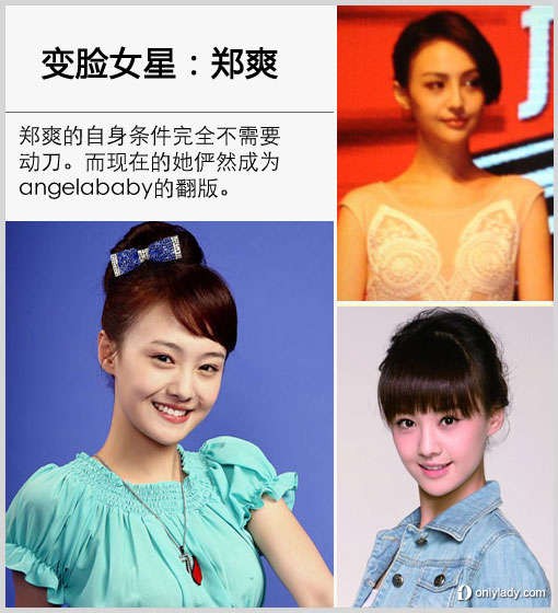 郑爽疑整容 盘点娱乐圈的变脸女星
