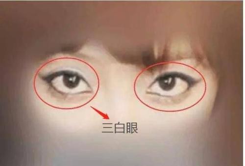 三白眼的女人能不能娶 下三白眼的女人漂亮吗