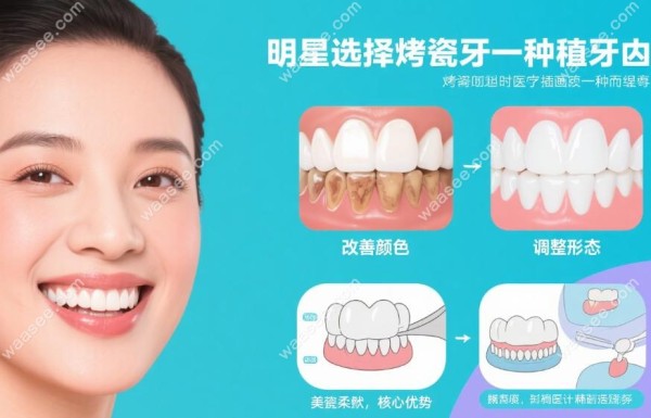 明星为什么不种牙而是烤瓷牙明星的选择