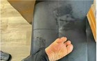 爆雷的私处“高潮针”，掏空2亿少妇！