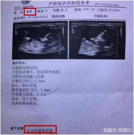 杨幂刘恺威离婚最新消息：卓伟朋友圈做诗回应，再次暗示李易峰？