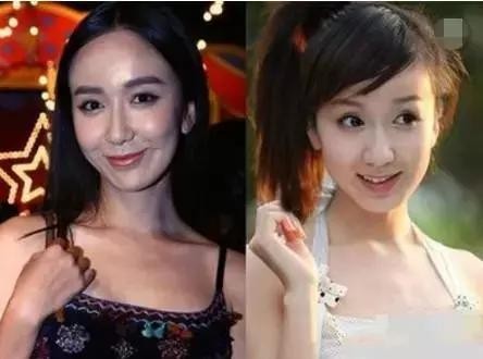 这些年被玻尿酸崩塌的明星：张信哲像蜡像，胡一菲脸部变形