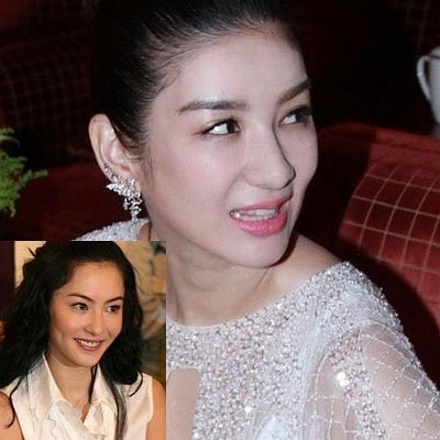 张柏芝、黄奕