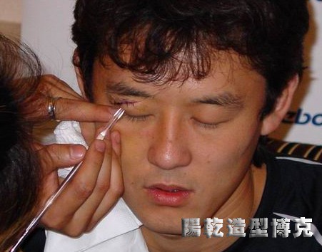 ★★★ 我为足球明星孙继海整容花絮