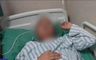 不要吃！不要喝！男子脑中取出18公分活虫