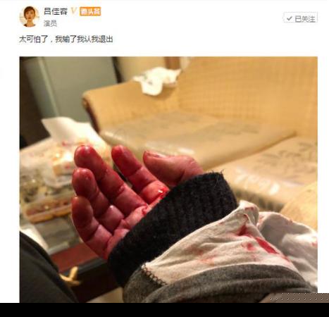 曾力挺李小璐的百变御姐吕佳容凌晨发割腕照片，并发文怀念乔任梁