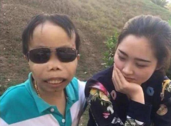 网红鼻祖陈山落魄到没钱住院?女友投靠散打,网友:他的女人谁敢要