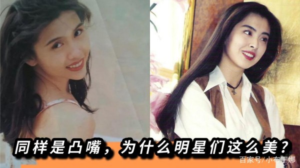 同样是凸嘴，为什么明星们这么美？