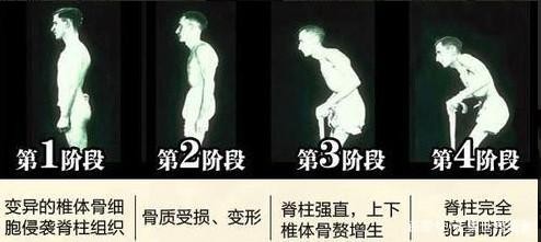 明星有钱也难治的2种病，张嘉译一步三晃，冯小刚不敢生孩子！