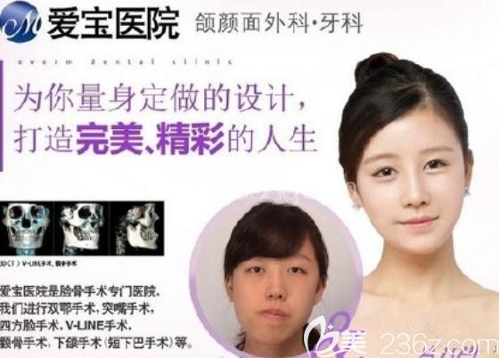 正颌面诊韩国爱宝尹奎植EU金钟润以及齐娥姜永浩说说感受及及三家价格对比
