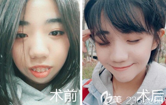 韩国EU案例