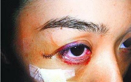 “三地两岸第一美人” 奉子成婚嫁入豪门, 一年内却被家暴七次