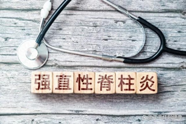 很多明星都患有的强直性脊柱炎是什么病？严重吗？一文告知你答案