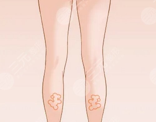 rd素瘦小腿身体塑形