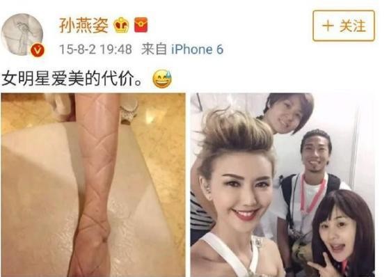 女明星惨不忍睹的脚，金星的充满了故事，赵丽颖最命苦！