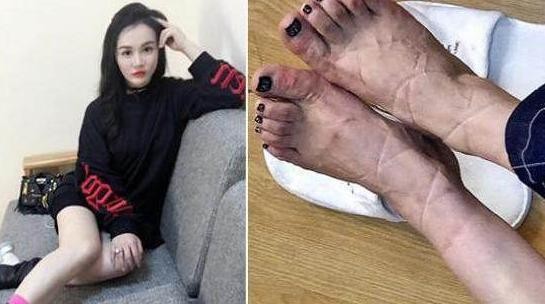 女明星惨不忍睹的脚，金星的充满了故事，赵丽颖最命苦！
