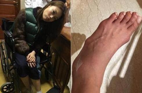 女明星惨不忍睹的脚，金星的充满了故事，赵丽颖最命苦！