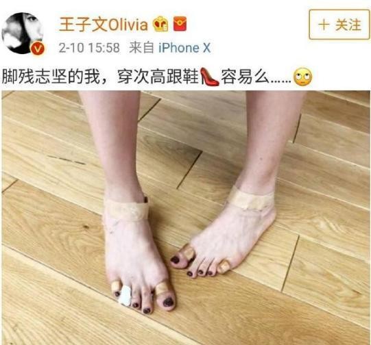 女明星惨不忍睹的脚，金星的充满了故事，赵丽颖最命苦！