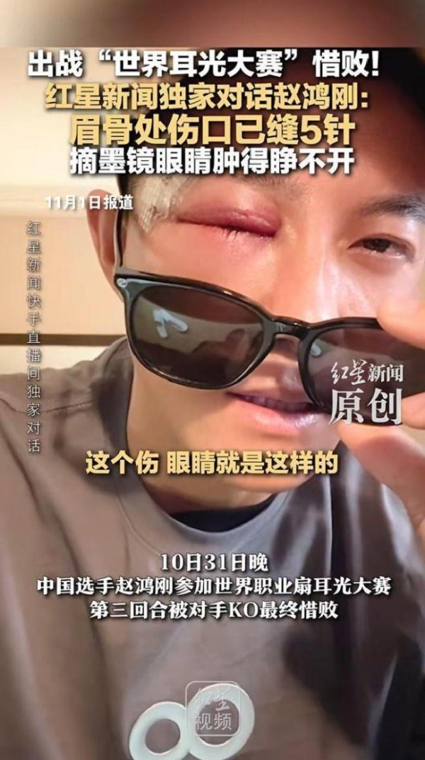 “耳光比赛”赵鸿刚谈失利:没经验 勇气与极限的反思