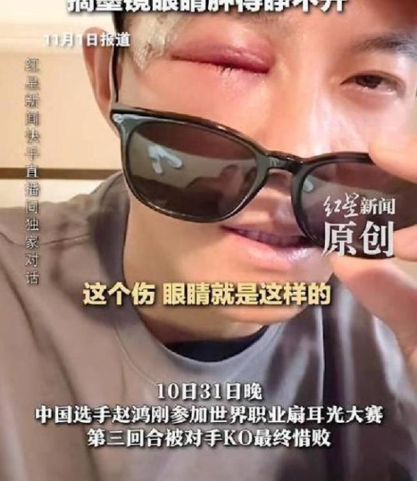 “耳光比赛”赵鸿刚谈失利:没经验 勇气与极限的反思