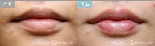 日式整形医生解析：如何拥有日本女明星般的日式精致脸？