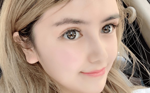 中法混血儿的额头较宽