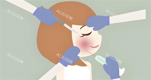 杭州蒋铮铮与梁敏雪玻尿酸注射图