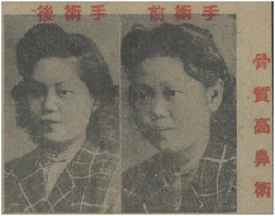 民国美女都是纯天然?其实当年明星整形成风