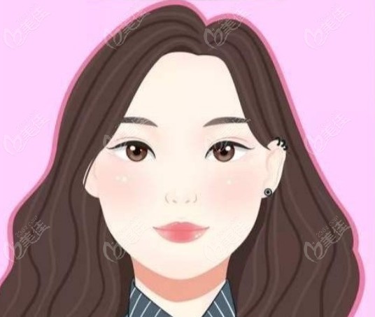 佀同帅修复双眼皮技术水平高口碑好