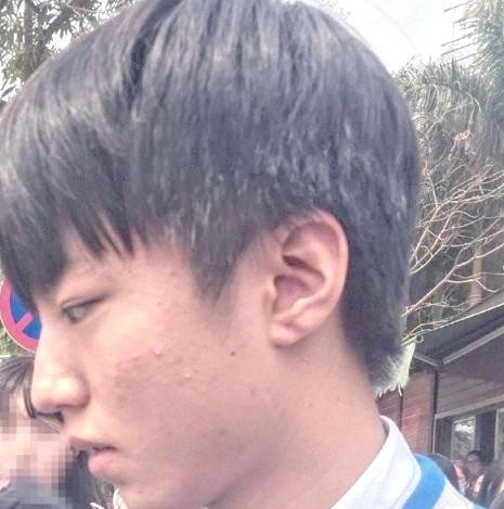 娱乐圈长痘的五大男明星：你是否认识他们？