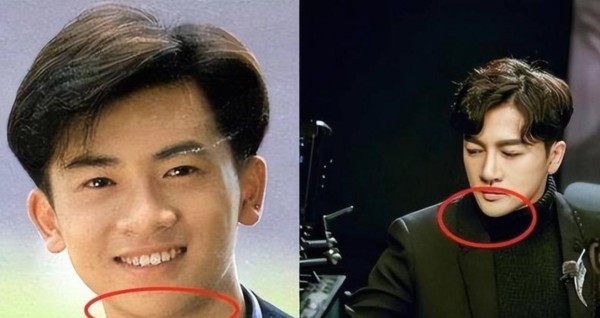 苏有朋真是糊涂被医美坑惨了，三天两头跑美容院修补旧伤，难怪网友都说他医美前才是最真实的样子