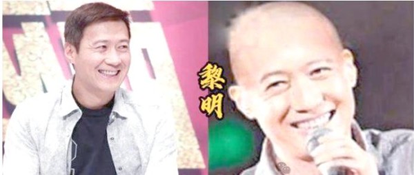 光头造型的魅力与潜在风险——从王安宇到阮经天的明星解析