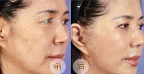 美容教主大S揭秘中国台湾明星保养秘方知多少？