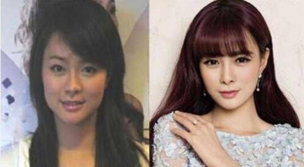 明星整容前后对照的图片 明星们整容前后