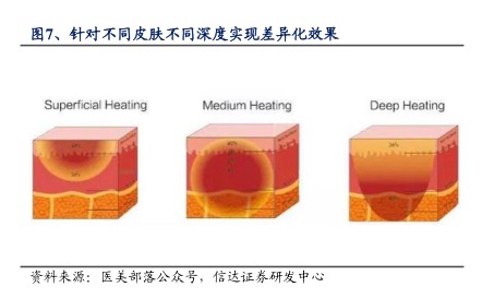 针对不同皮肤不同深度实现差异化效果 - 2024年04月 - 行业研究数据