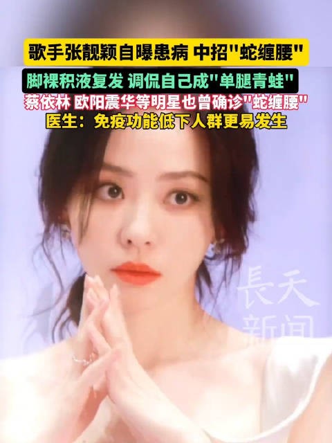 蔡依林也曾受带状疱疹困扰