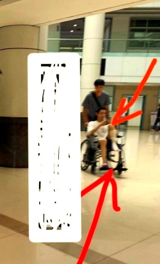 明星拍戏受伤频发：崴脚后的全面康复指南