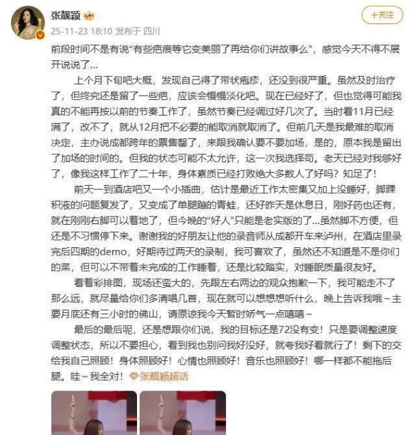 单腿蹦的青蛙到舞台中央！张靓颖带病工作，揭秘明星背后的辛酸