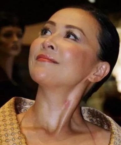 因“吻痕”暴露恋情的明星，第三位尴尬，最后一位用粉底也遮不住