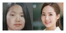 公开承认“整容”的4个女星，郑爽开眼角，而她整了3次成功变美