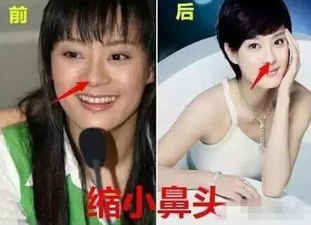 孙俪体检报告出炉 一句话道破当女明星的难处-信息快讯网