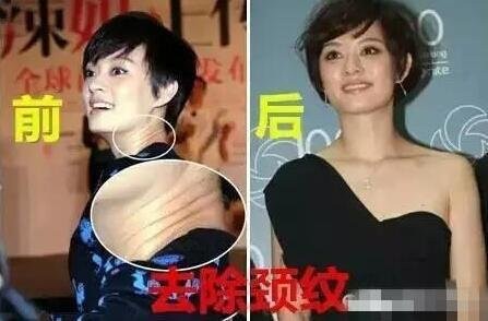 孙俪体检报告出炉 一句话道破当女明星的难处-信息快讯网