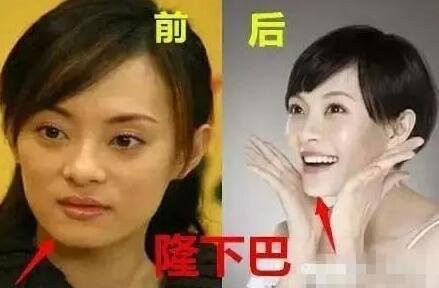 孙俪体检报告出炉 一句话道破当女明星的难处-信息快讯网