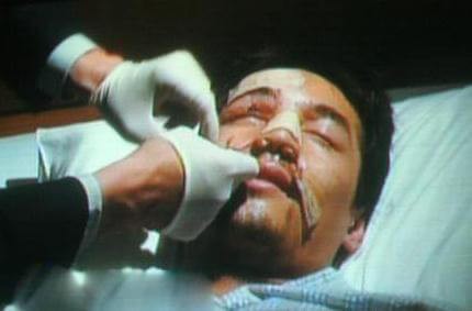 胡歌的老婆王晓晨个人资料曝光 称不介意胡歌车祸前后照片眼角留疤 第2张