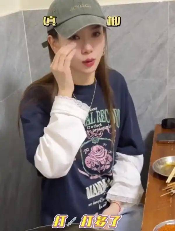 “上节目眼睛变形”，知名女星自曝：肉毒素打多了