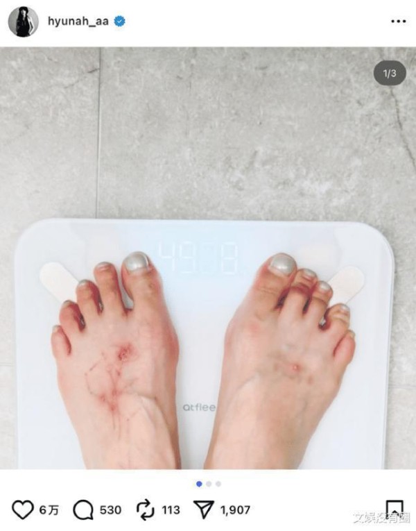 泫雅体重波动让人意外？明星健康管理到底有多难？