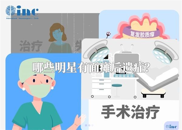 哪些明星有面瘫后遗症?