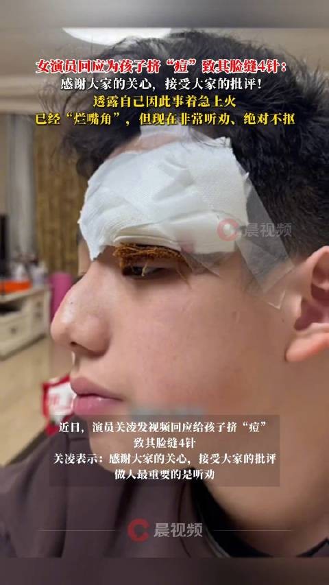 演员关凌回应给孩子挤痘事件：感谢大家的关心，接受大家的批评！