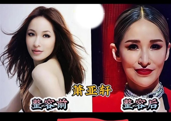 那些年整容过头的明星，如今都怎么样了？